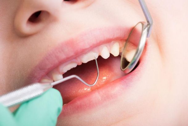 Dental Care For Special Needs Children