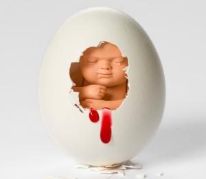 Handling Miscarriage